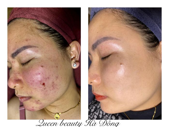Hình ảnh không gian sang trọng tại Queen Spa & Clinic