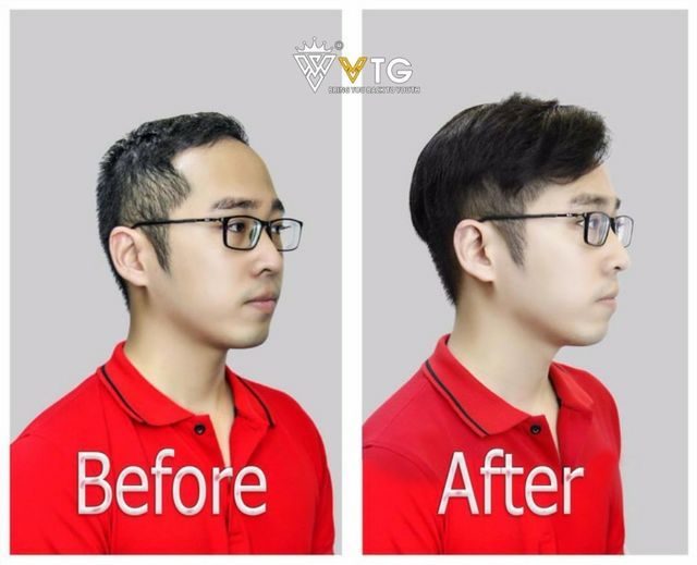 Trải nghiệm thực tế khách hàng sử dụng tóc giả nam Vua Tóc Giả