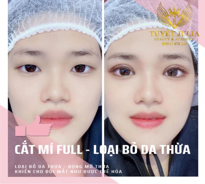 Tuyết Julia Beauty hình ảnh 1
