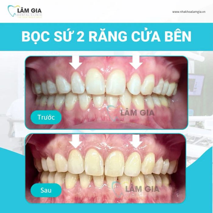 Nha Khoa Lâm Gia ảnh 1