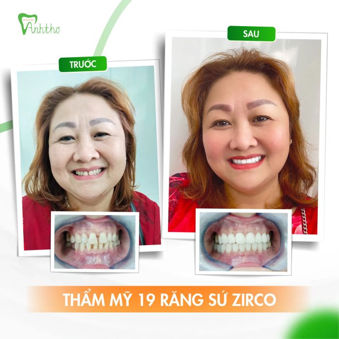 Nha Khoa Anh Thơ ảnh 2