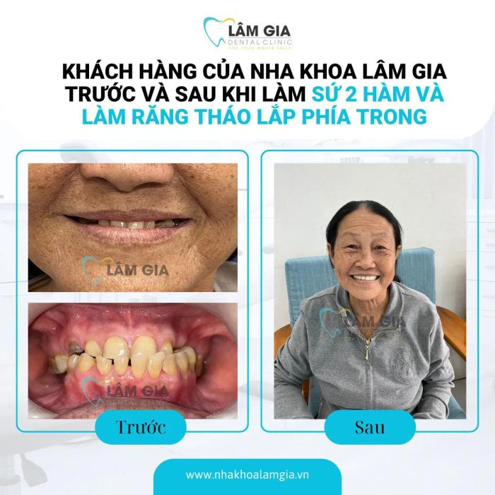 Nha Khoa Lâm Gia ảnh 2
