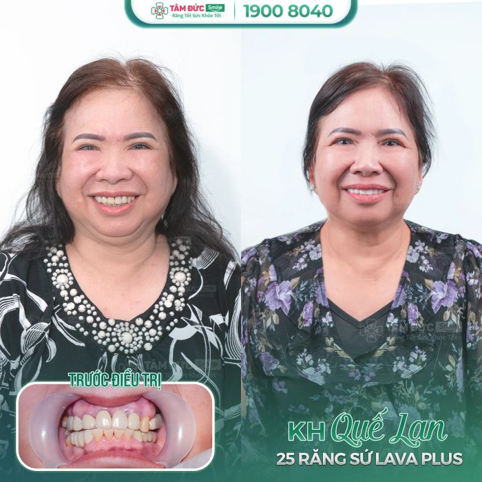 Nha Khoa Tâm Đức Smile - Cần Thơ ảnh 2