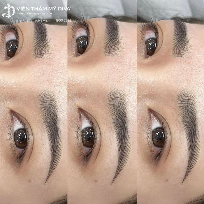 Bộ sưu tập hình ảnh ấn tượng về quy trình làm đẹp chuẩn y khoa tại Viện Thẩm Mỹ DIVA Bảo Lộc