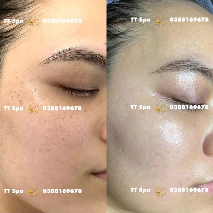 Không gian sang trọng và hiện đại tại TT Spa