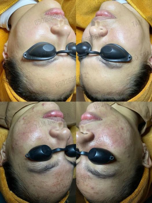 Không gian trị liệu sang trọng tại Tâm Ngô Spa