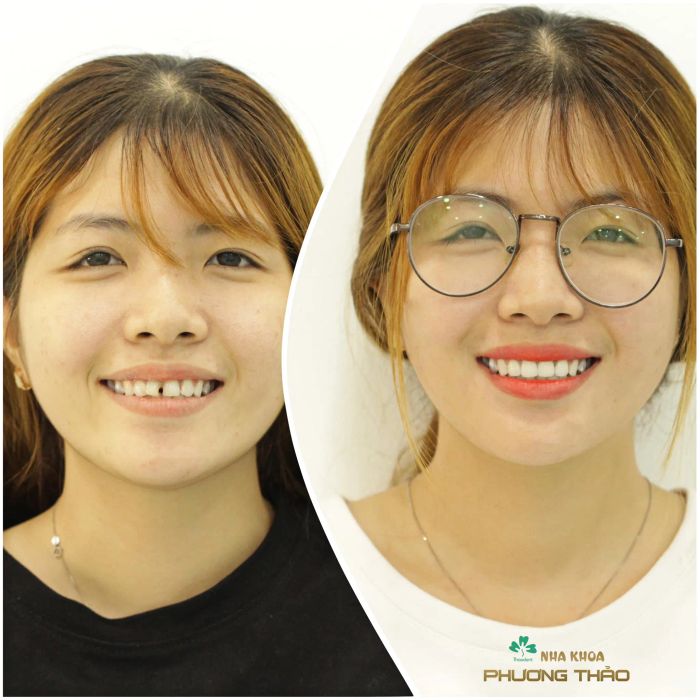 Nha Khoa Phương Thảo ảnh 1