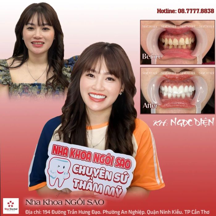 Star Dental - Nha Khoa Ngôi Sao ảnh 1