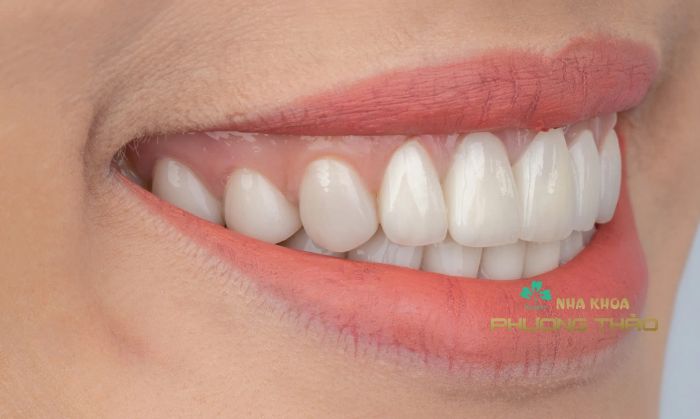 Nha Khoa Phương Thảo ảnh 2