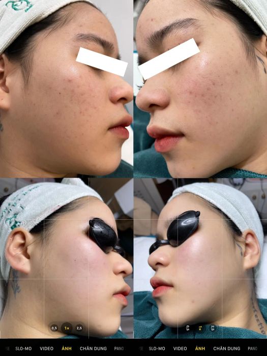 Hình ảnh liệu trình chăm sóc da tại NgocQueenSpa Beauty & Nail