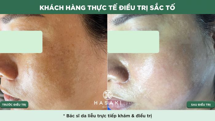 Hasaki Beauty & Clinic - Nơi gửi trọn niềm tin làm đẹp