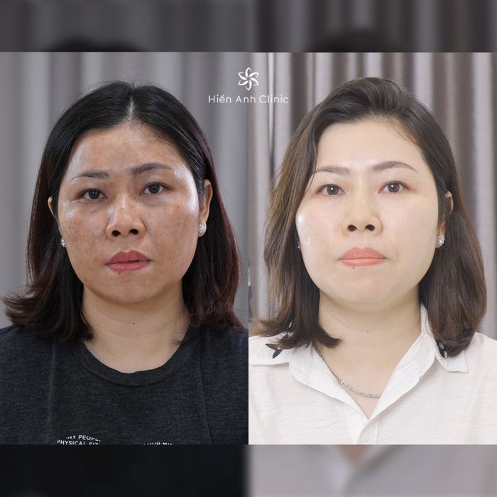 Hiền Anh Clinic - Nơi gửi trọn niềm tin chăm sóc da chuyên nghiệp