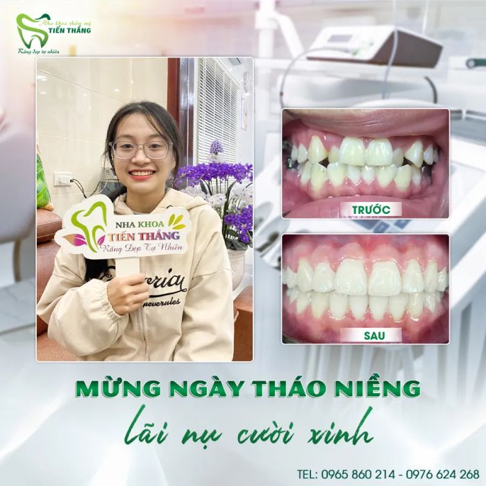 NHA KHOA TIẾN THẮNG hình ảnh 2