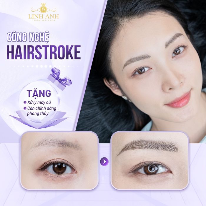 Quy trình làm đẹp chuyên nghiệp tại Linh Anh Beauty