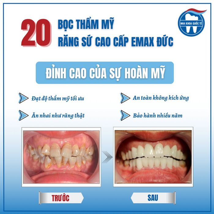 Hình ảnh thực tế Nha Khoa Quốc Tế Quảng Ninh - Ảnh 2 chất lượng cao