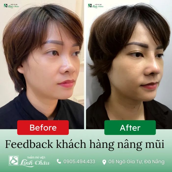 Hệ thống phòng điều trị cao cấp tại Thẩm mỹ viện Linh Châu