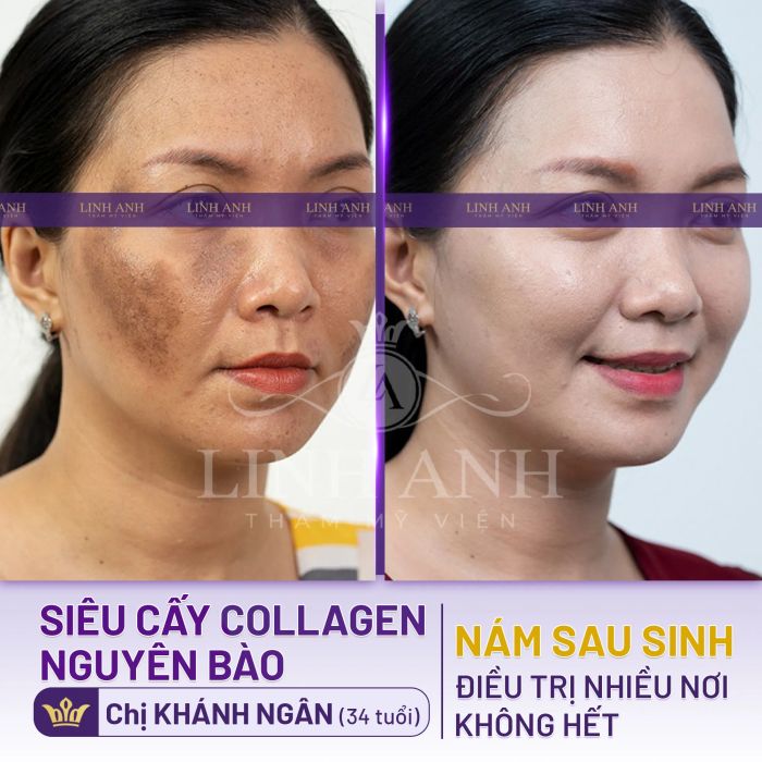 Hệ thống phòng điều trị cao cấp tại Viện Thẩm Mỹ Linh Anh