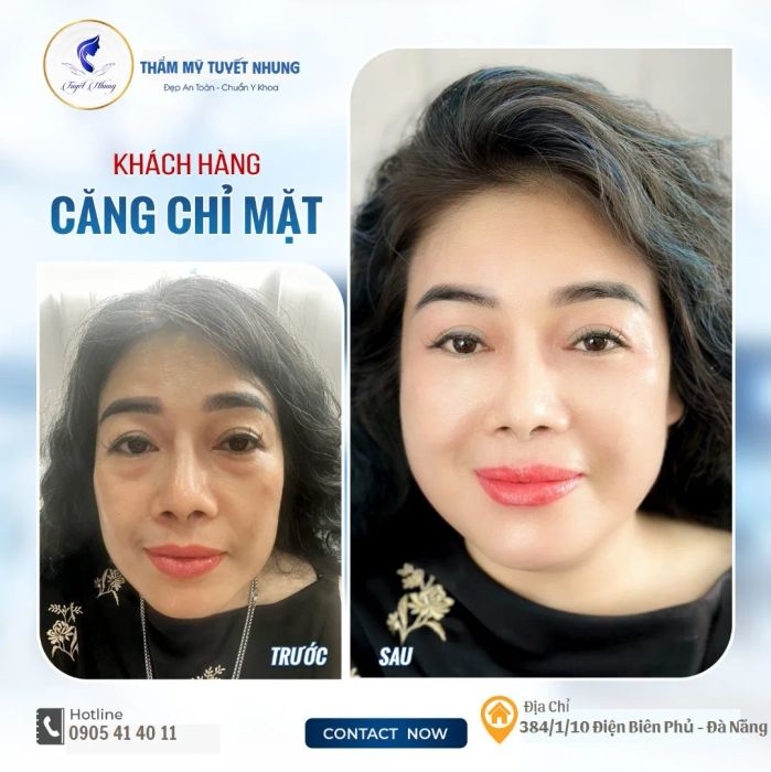 Không gian sang trọng tại Thẩm mỹ viện Tuyết Nhung