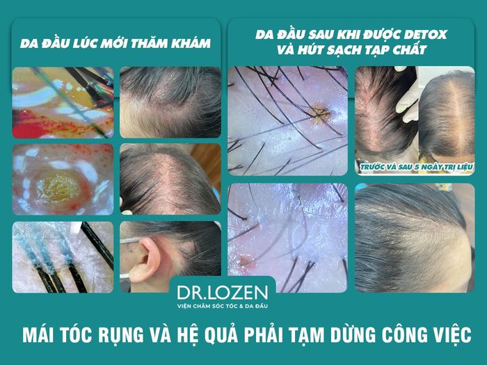 Quy trình điều trị chuyên nghiệp tại Dr.Lozen Vietnam
