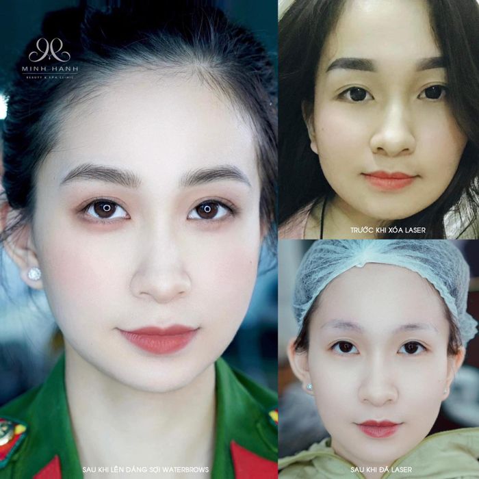 Hình ảnh 2 về Minh Hanh Beauty