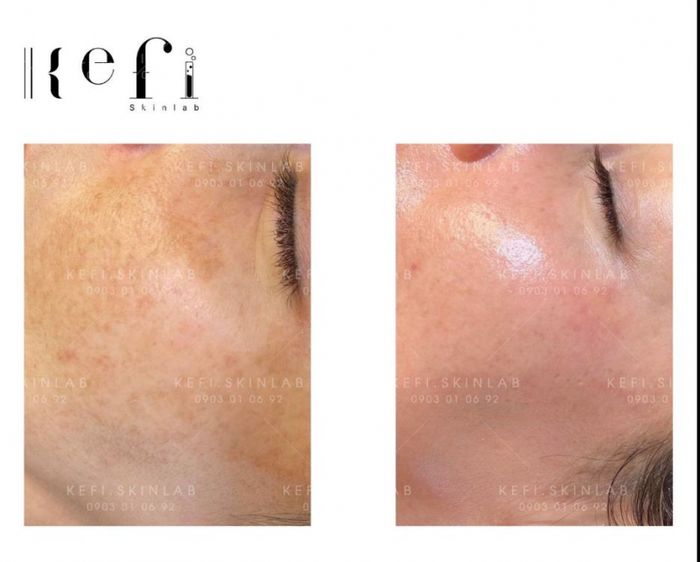 Kefi Skinlab - Không gian hiện đại đạt chuẩn quốc tế