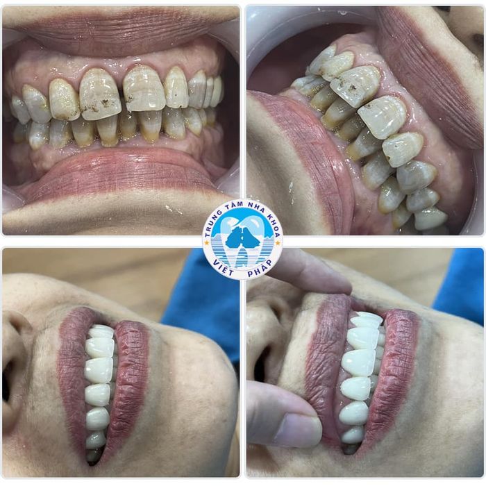 Hình ảnh thực tế tại Nha Khoa Việt Pháp Quảng Ninh