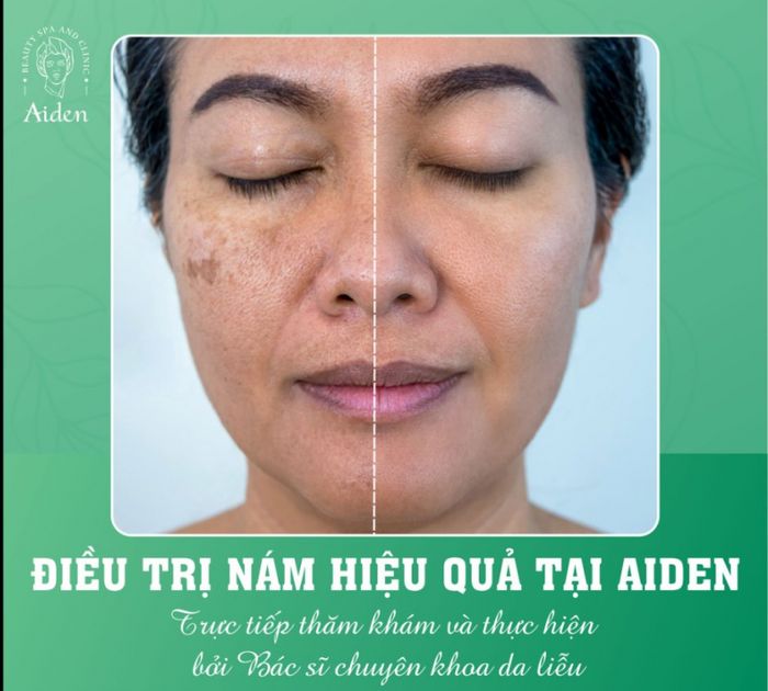 Hình ảnh Aiden Beauty Spa & Clinic - Không gian sang trọng đạt chuẩn quốc tế