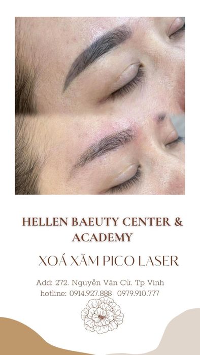 Hình ảnh 2 về Học Viện Thẩm Mỹ Quốc Tế Hellen