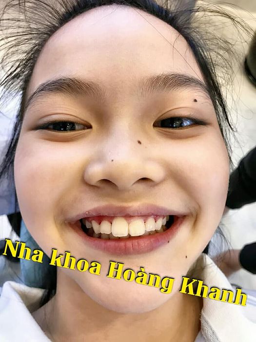 Nha Khoa Hoàng Khanh - Ảnh 1