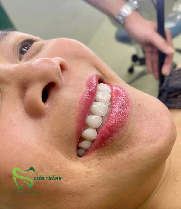 NHA KHOA TIẾN THẮNG hình ảnh 1