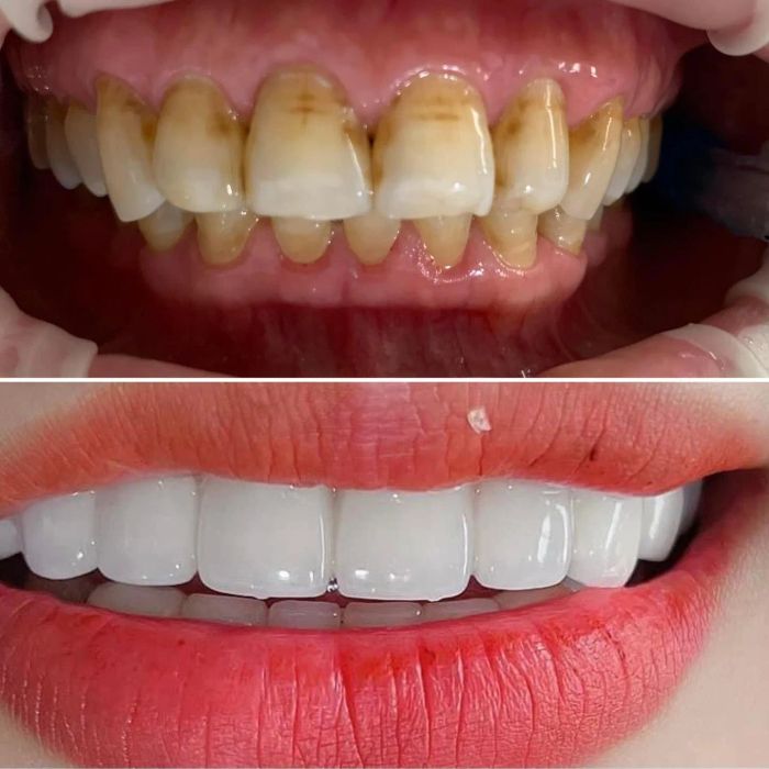 Nha Khoa Hà Nội - Yên Thành, Nghệ An hình ảnh 2