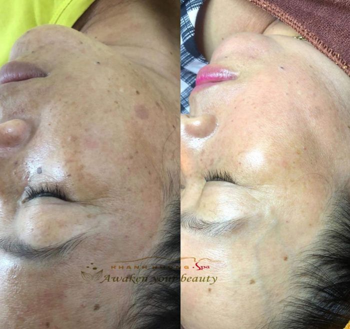 Khánh Hương Spa - Nơi gửi gắm làn da tươi trẻ