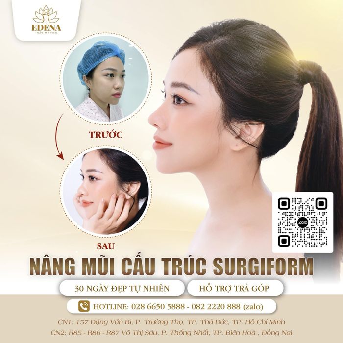 Hình ảnh quy trình chăm sóc da chuyên nghiệp tại EDENA