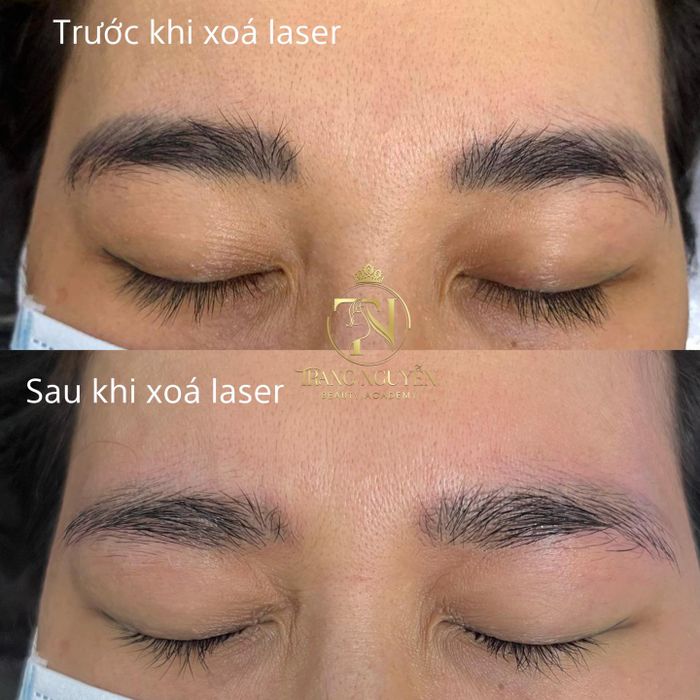 Hình ảnh về Học viện Thẩm mỹ Trang Nguyễn