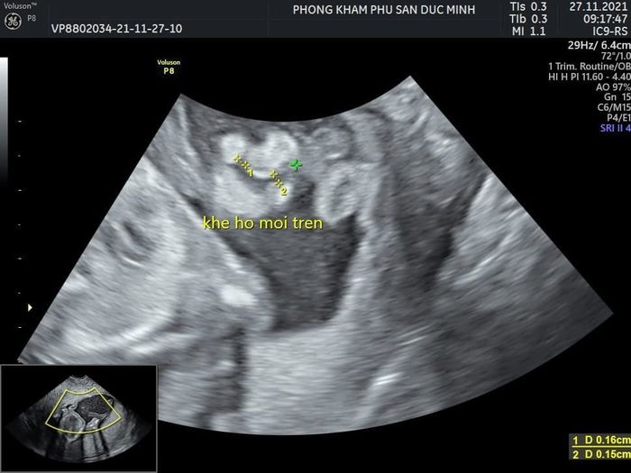 Phòng Khám Phụ Sản Đức Minh ảnh 2