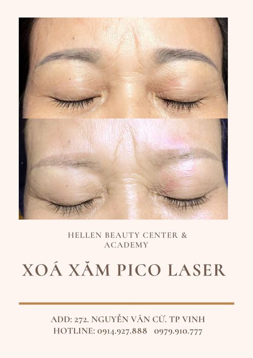 Hình ảnh 1 về Học Viện Thẩm Mỹ Quốc Tế Hellen