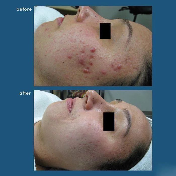 Không gian trị liệu tại Sunshine Spa & Beauty Clinic