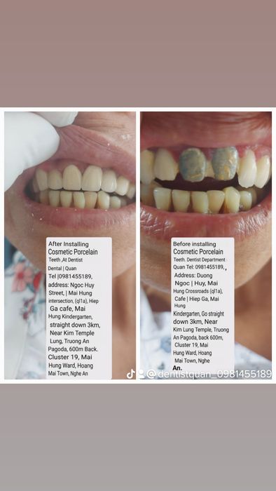 Hình ảnh ấn tượng về Nha Khoa Dentist Quân