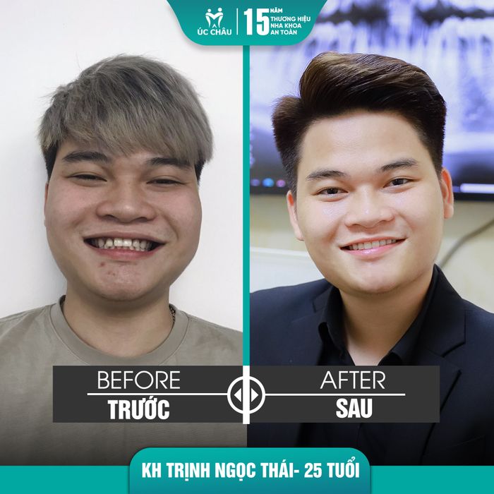 Hình ảnh cơ sở vật chất hiện đại tại Nha Khoa Úc Châu - Ảnh 1
