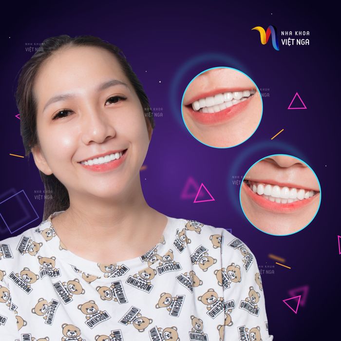 NHA KHOA VIỆT NGA - Vũng Tàu (ảnh 1)