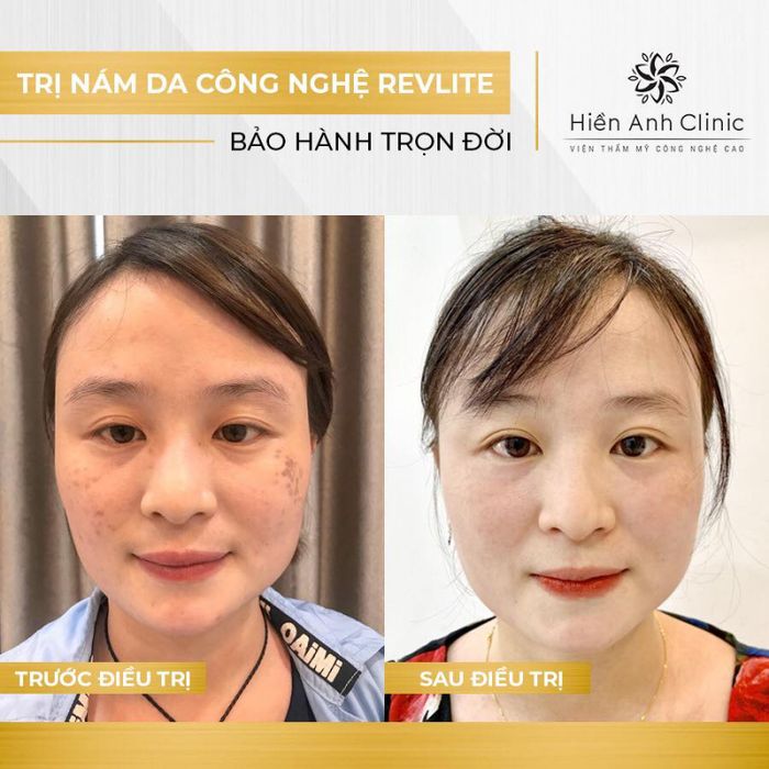 Hiền Anh Clinic - Không gian thẩm mỹ sang trọng và hiện đại