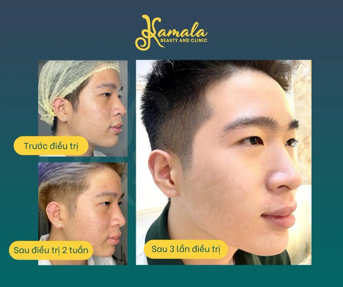 Không gian trị liệu sang trọng tại Kamala Beauty & Clinic