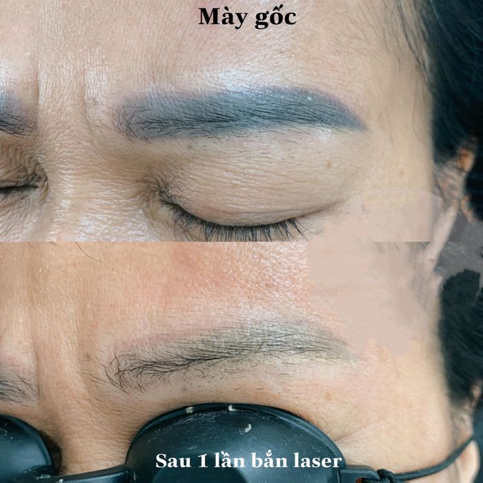Hình ảnh 1 về Học Viện Thẩm Mỹ Thanh Huyền