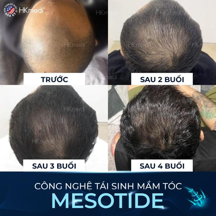 Không gian điều trị tiêu chuẩn tại Phòng Khám Da Liễu Hoa Kỳ