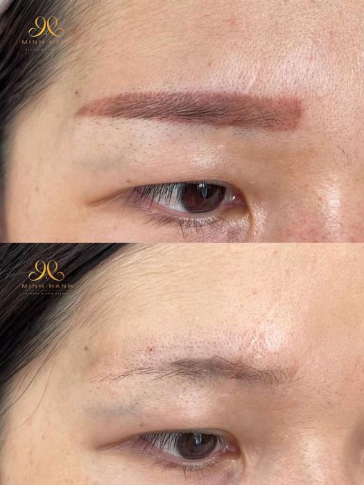 Hình ảnh 1 về Minh Hanh Beauty