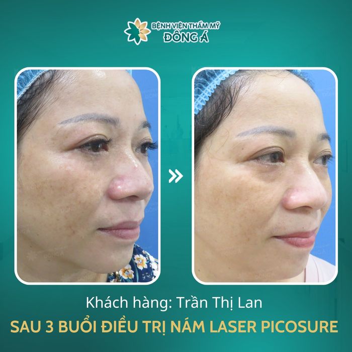 Hình ảnh Bệnh Viện Thẩm Mỹ Đông Á - Nơi gửi trọn niềm tin cho làn da sạch nám
