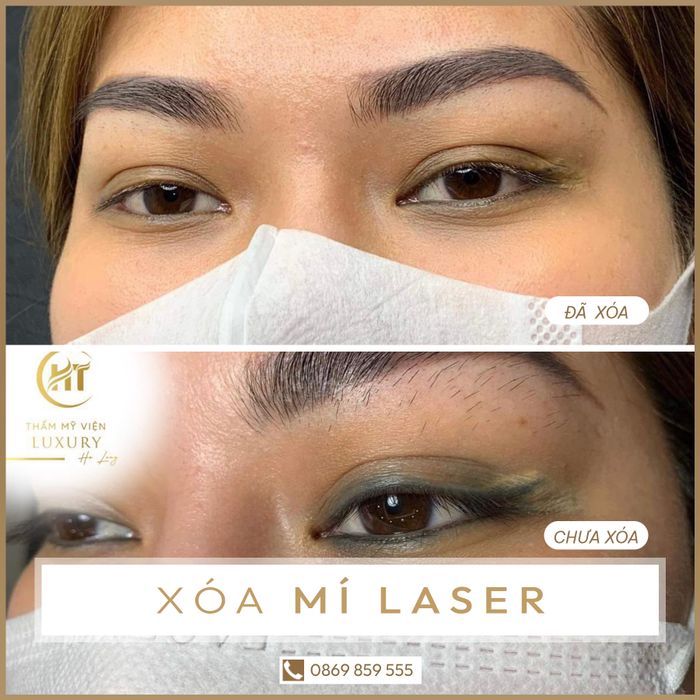 Hình ảnh thứ hai ghi lại không gian đẳng cấp tại Thẩm mỹ viện Luxury