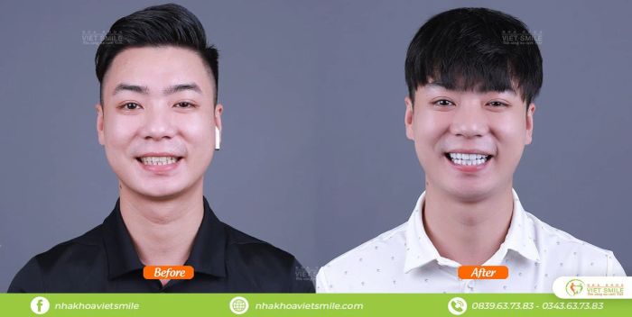 Nha Khoa VIET SMILE ảnh 1