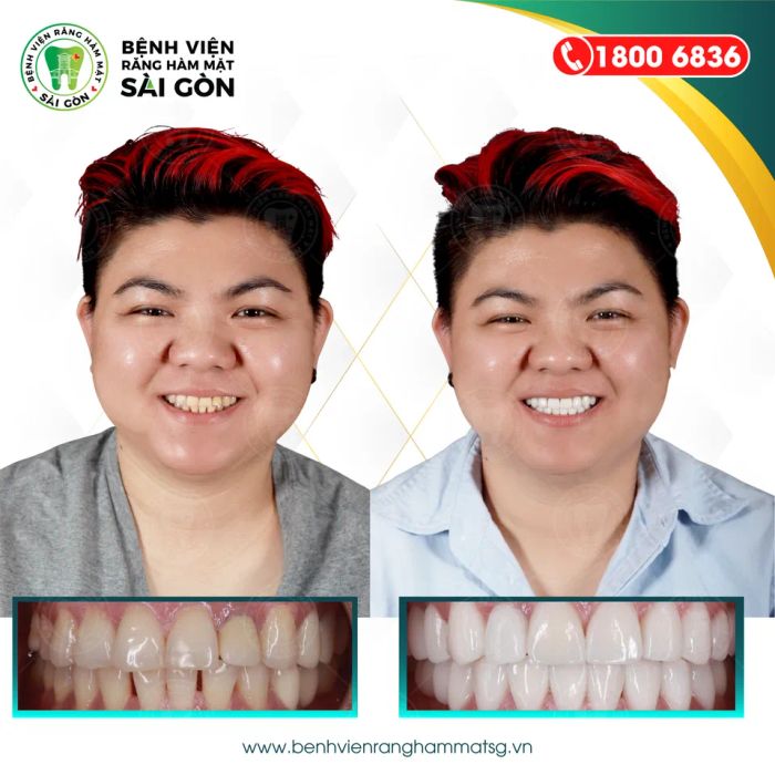 Bệnh Viện Răng Hàm Mặt Sài Gòn ảnh 2