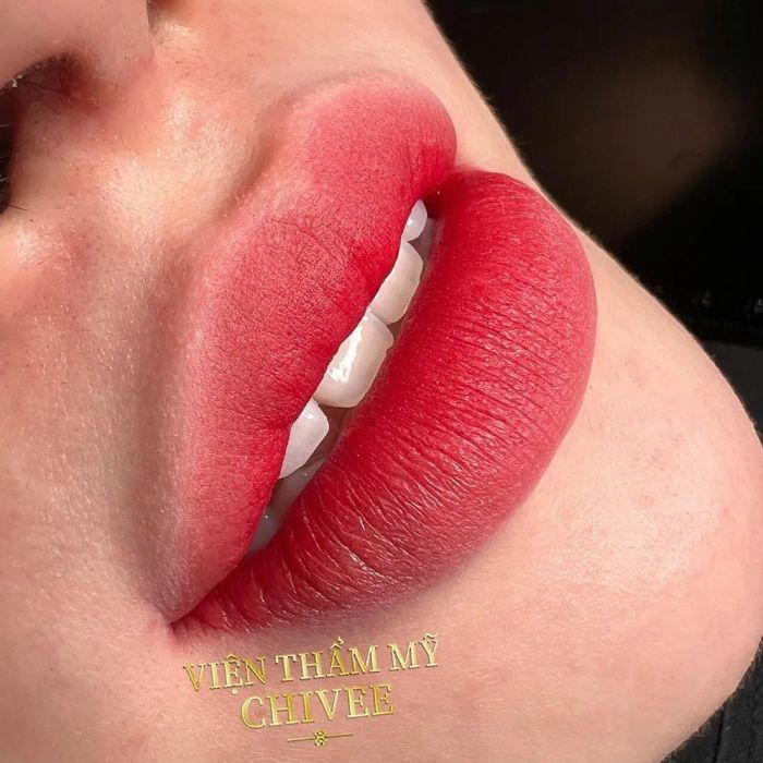 Hình ảnh Viện Thẩm Mỹ ChiVee - Cơ sở làm đẹp uy tín